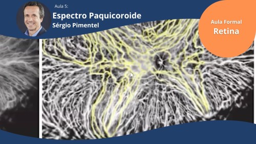 Retina Aula 5: Espectro Paquicoroide